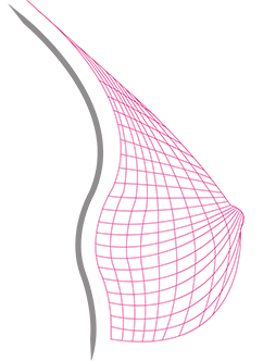 ABC Breastcare Brustprothese nach Maß Silikonprothese Maßanfertigung